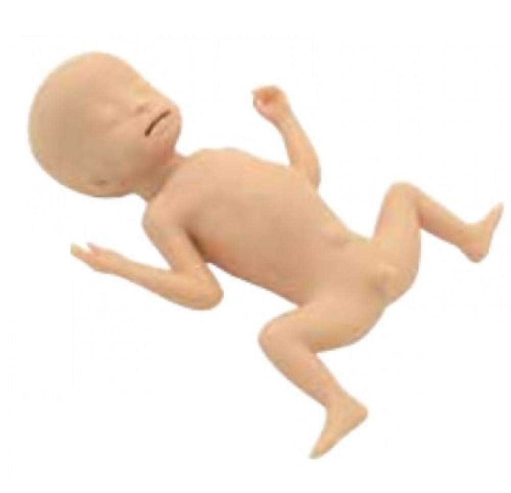 MODELO DE TRATAMIENTO DE ULCERAS DE DECUBITO