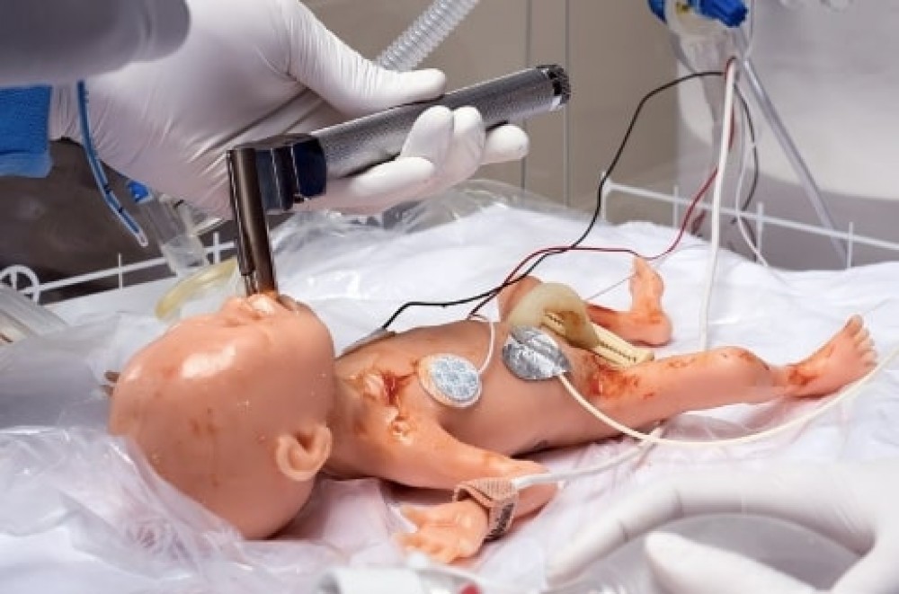 Kit personalizado de tejidos cardiacos