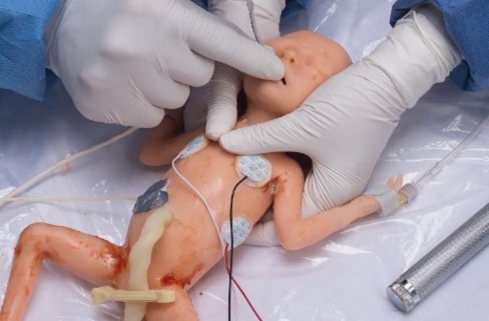 Intestino de capa sencilla